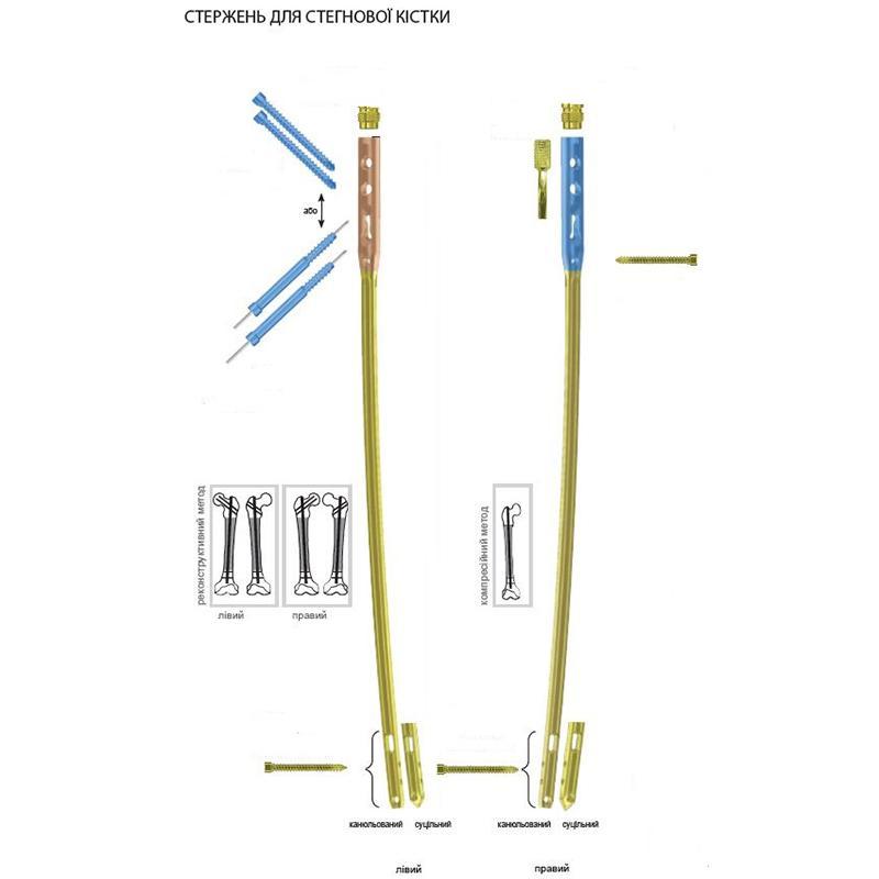Стержень універсальний для інтрамедулярного остеосинтезу стегнової кістки Charfix